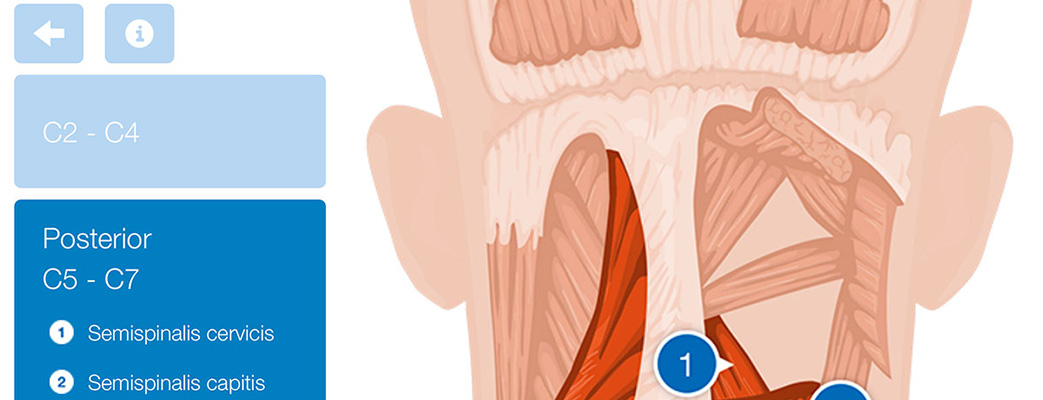 Tratamiento distonía cervical